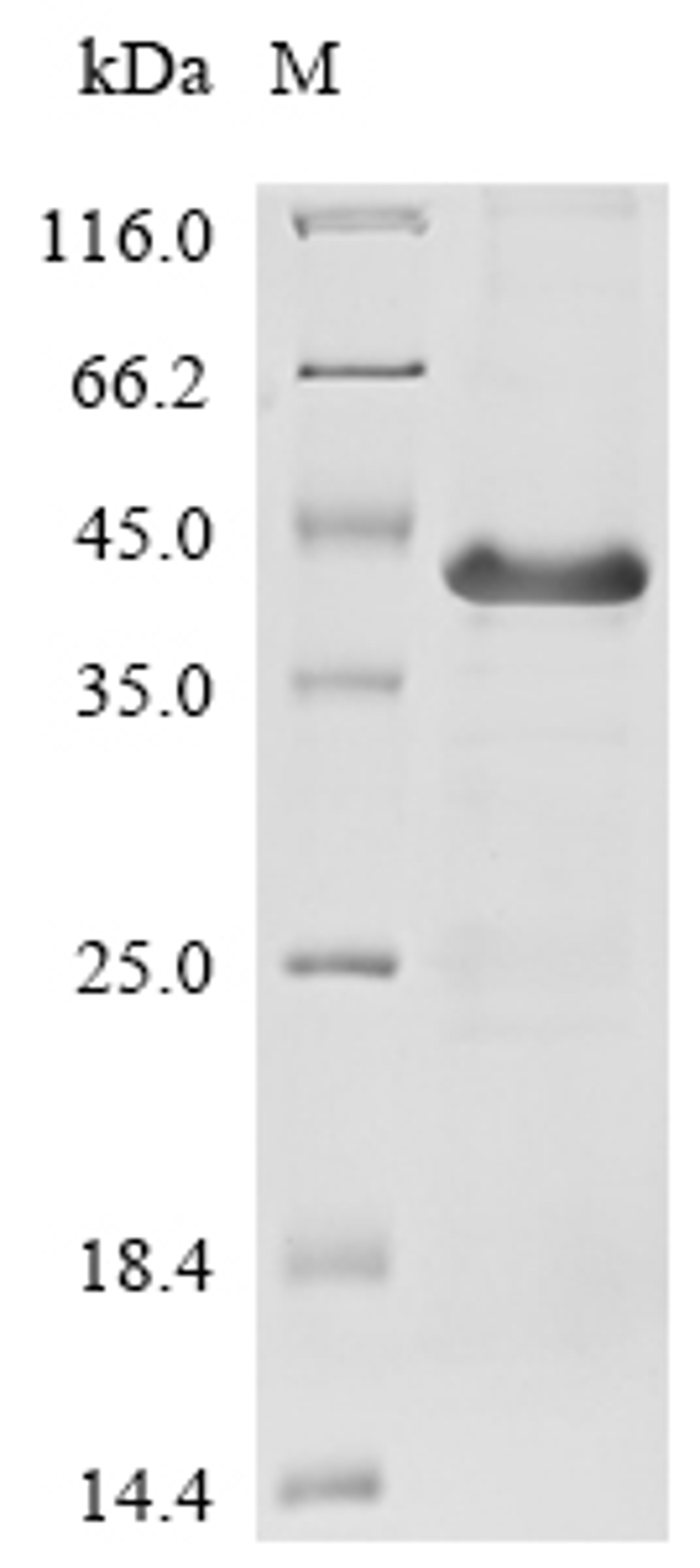 (Tris-Glycine gel) Discontinuous SDS-PAGE (reduced) with 5% enrichment gel and 15% separation gel.