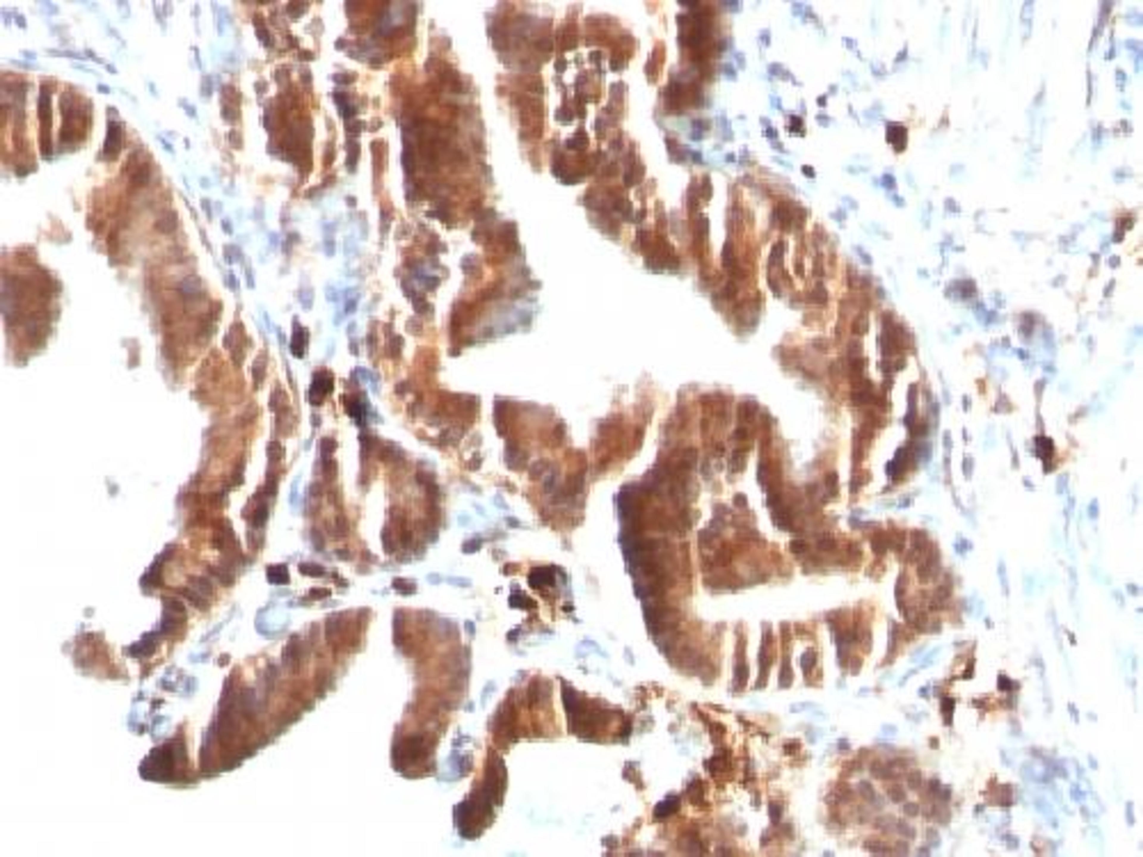 Immunohistochemical staining of human Gallbladder tissue using TOP1MT antibody