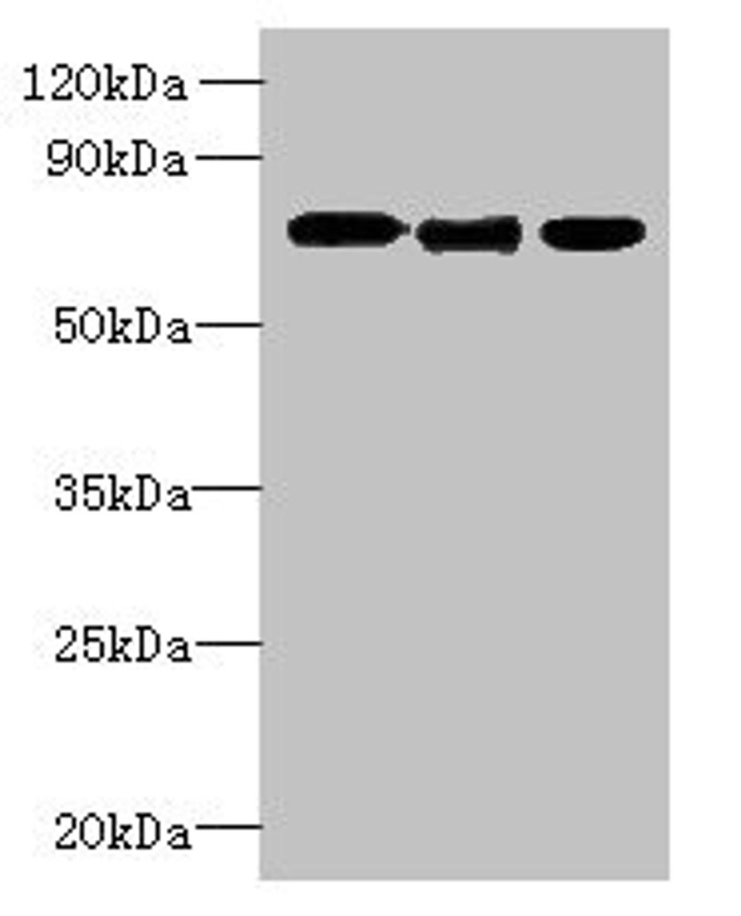 Western blot. All lanes: SLC23A1 antibody at 3ug/ml. Lane 1: A549 whole cell lysate. Lane 2: Mouse liver tissue. Lane 3: Mouse kidney tissue. Secondary. Goat polyclonal to rabbit IgG at 1/10000 dilution. Predicted band size: 65, 66, 29 kDa. Observed band size: 65 kDa. 