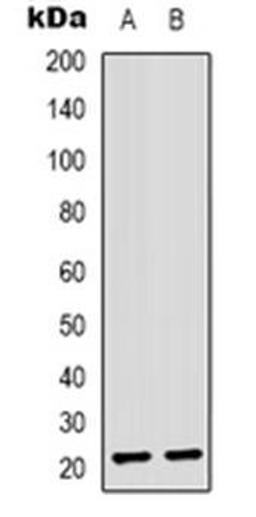 Western blot analysis of ASF1B expression in Jurkat (Lane 1), Hela (Lane 2) whole cell lysates using ASF1B antibody