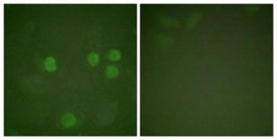 Immunocytochemistry/Immunofluorescence: Cyclin B1 Antibody [NBP1-61243] - Analysis of HeLa cells, using Cyclin B1  Antibody. The picture on the right is treated with the synthesized peptide.