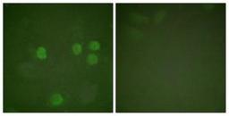 Immunocytochemistry/Immunofluorescence: Cyclin B1 Antibody [NBP1-61243] - Analysis of HeLa cells, using Cyclin B1  Antibody. The picture on the right is treated with the synthesized peptide.