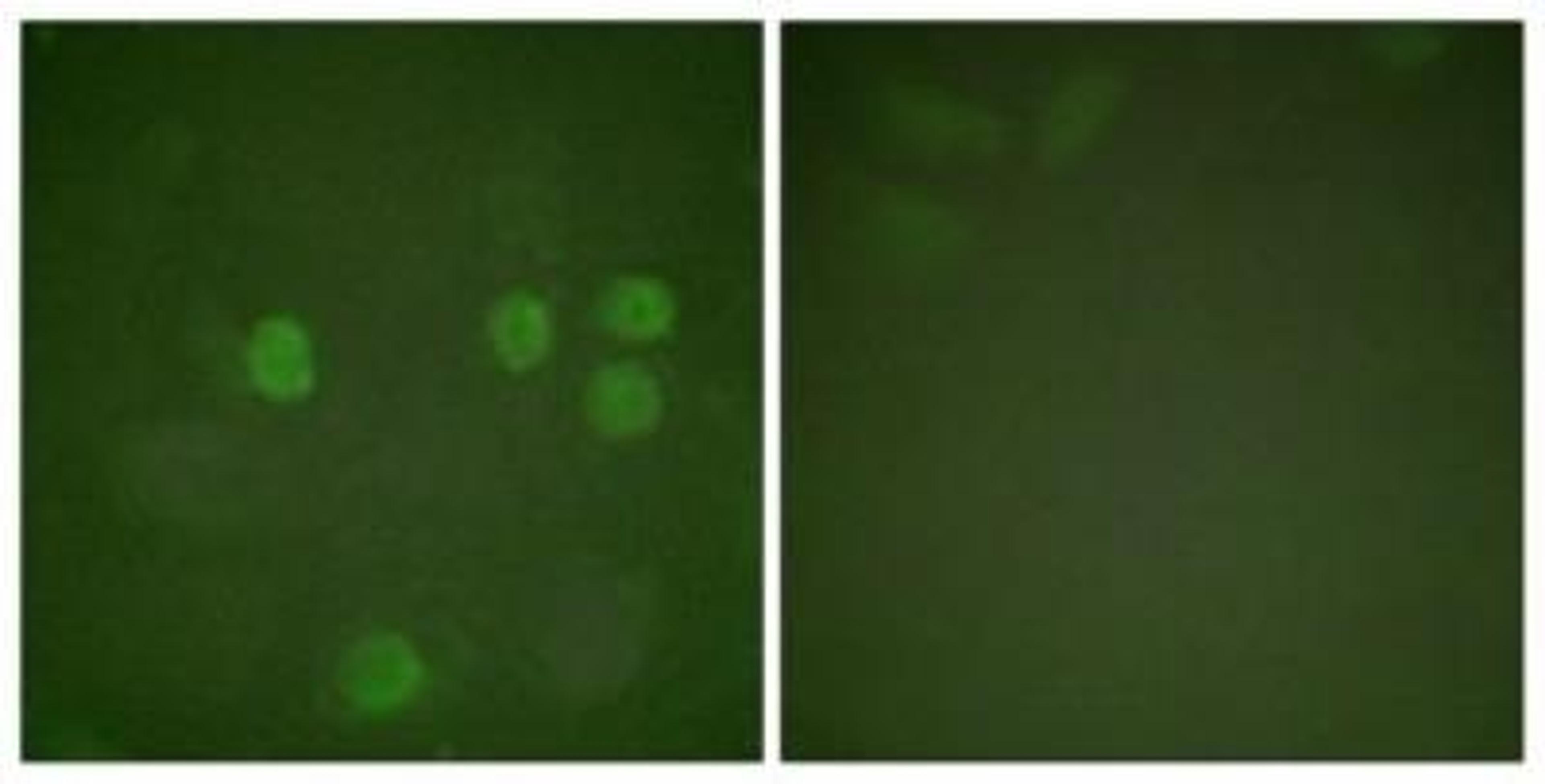 Immunocytochemistry/Immunofluorescence: Cyclin B1 Antibody [NBP1-61243] - Analysis of HeLa cells, using Cyclin B1  Antibody. The picture on the right is treated with the synthesized peptide.