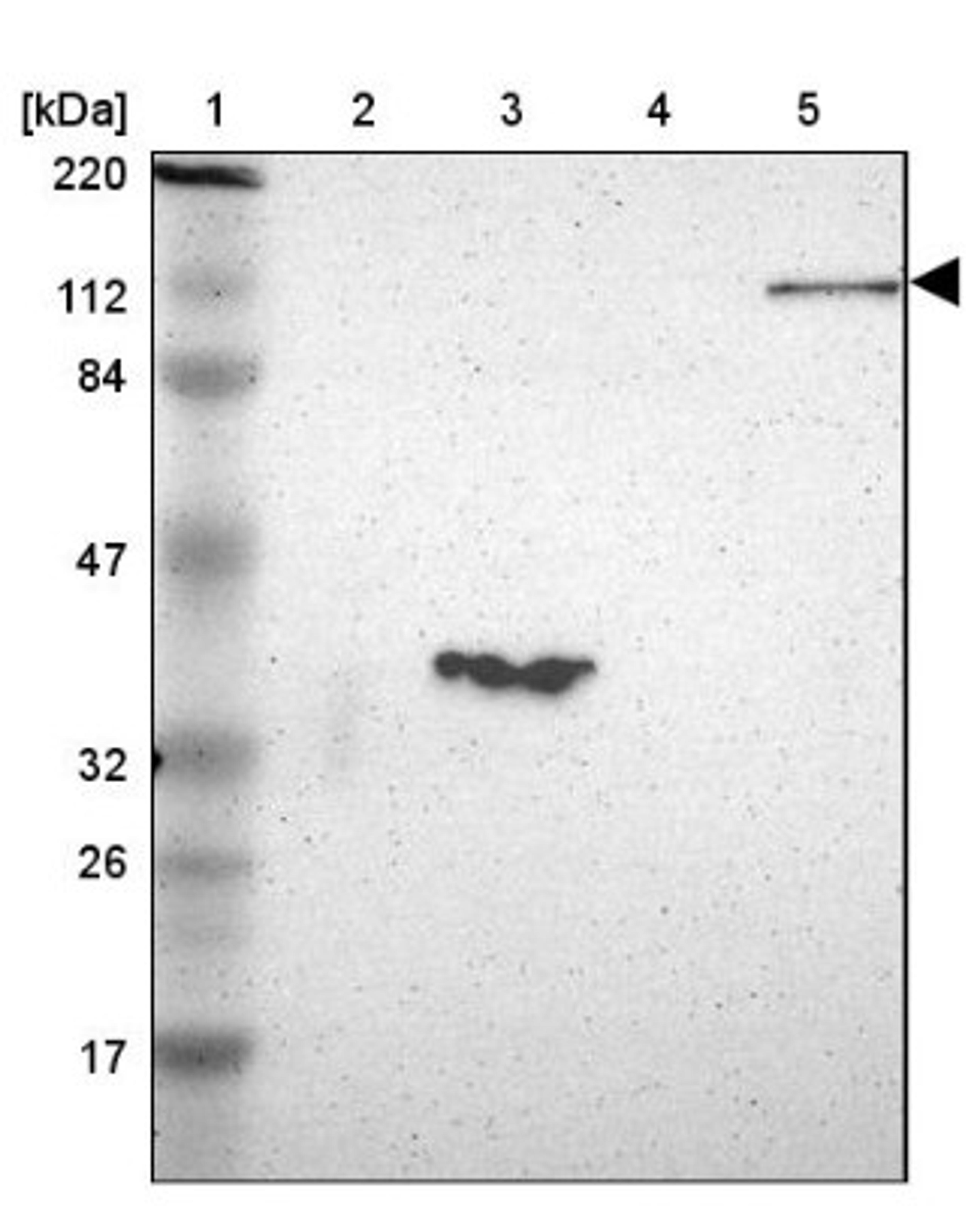 Western Blot: FAM65A Antibody [NBP1-83695] - Lane 1: Marker [kDa] 220, 112, 84, 47, 32, 26, 17<br/>Lane 2: Human cell line RT-4<br/>Lane 3: Human cell line U-251MG sp<br/>Lane 4: Human plasma (IgG/HSA depleted)<br/>Lane 5: Human liver tissue