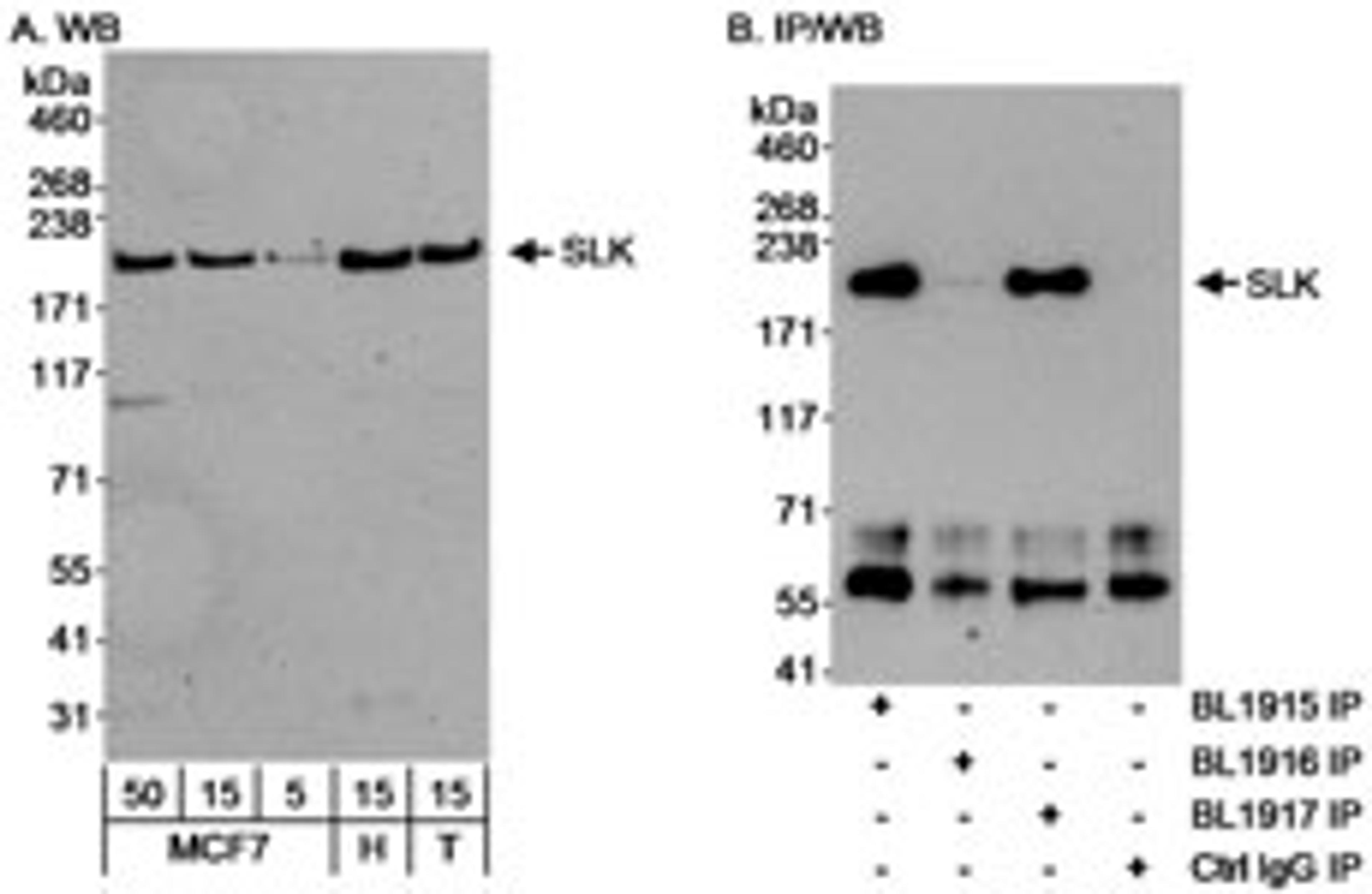 Detection of human SLK by western blot and immunoprecipitation.