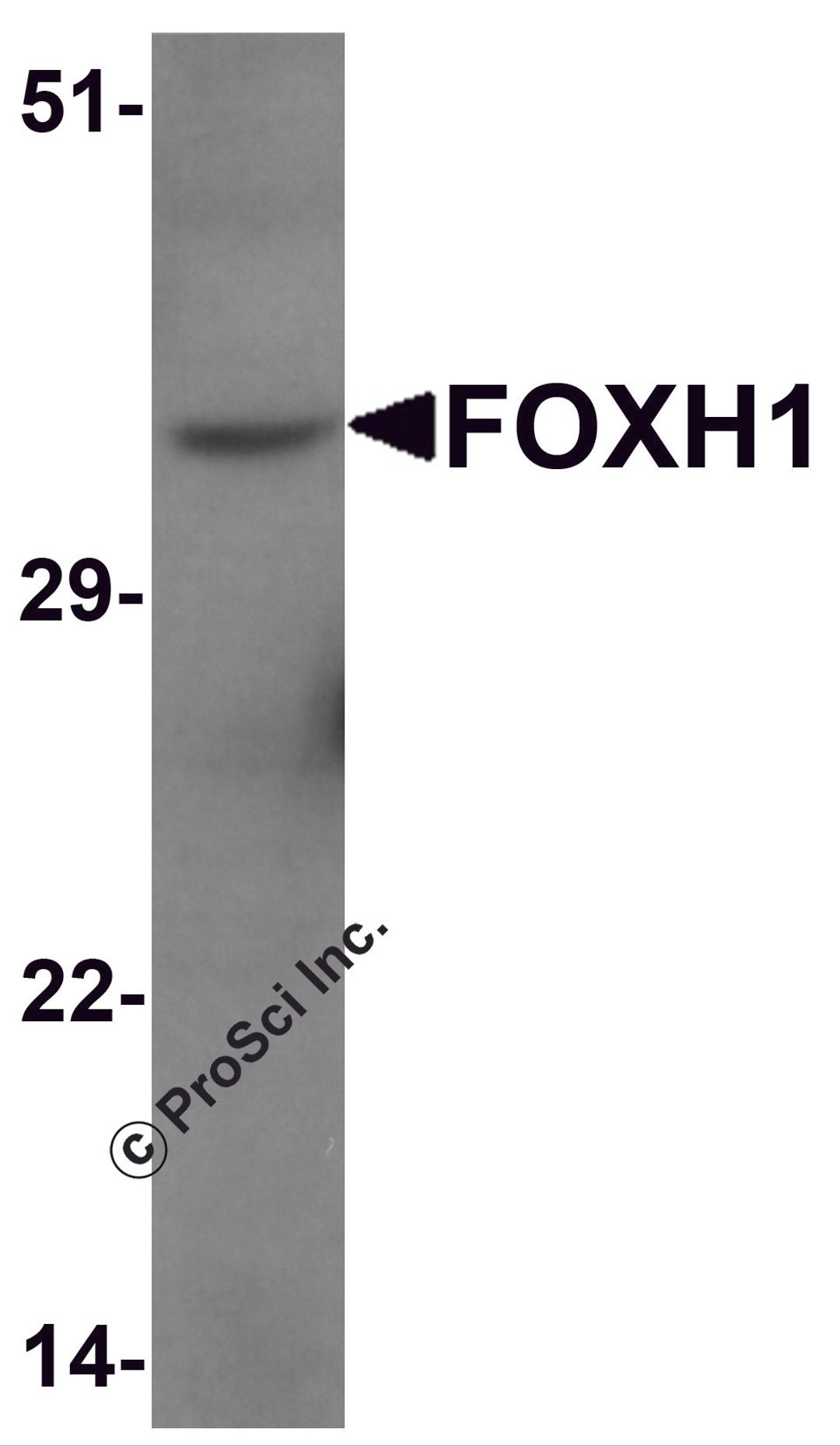 Western blot analysis of FOXH1 in human liver tissue lysate with FOXH1 antibody at 1 &#956;g/mL.