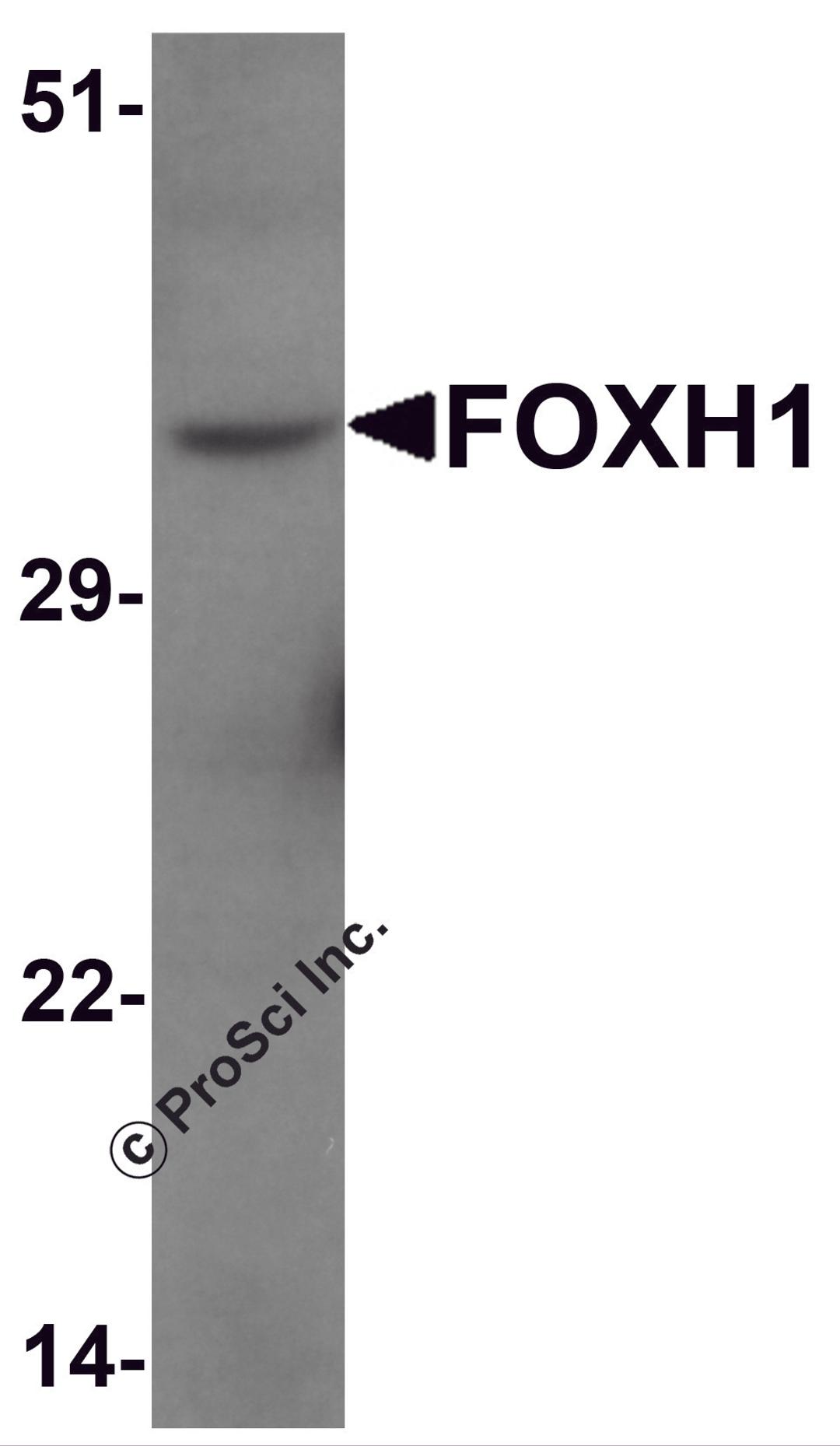 Western blot analysis of FOXH1 in human liver tissue lysate with FOXH1 antibody at 1 μg/mL.