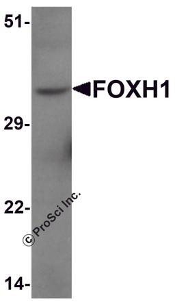 Western blot analysis of FOXH1 in human liver tissue lysate with FOXH1 antibody at 1 μg/mL.