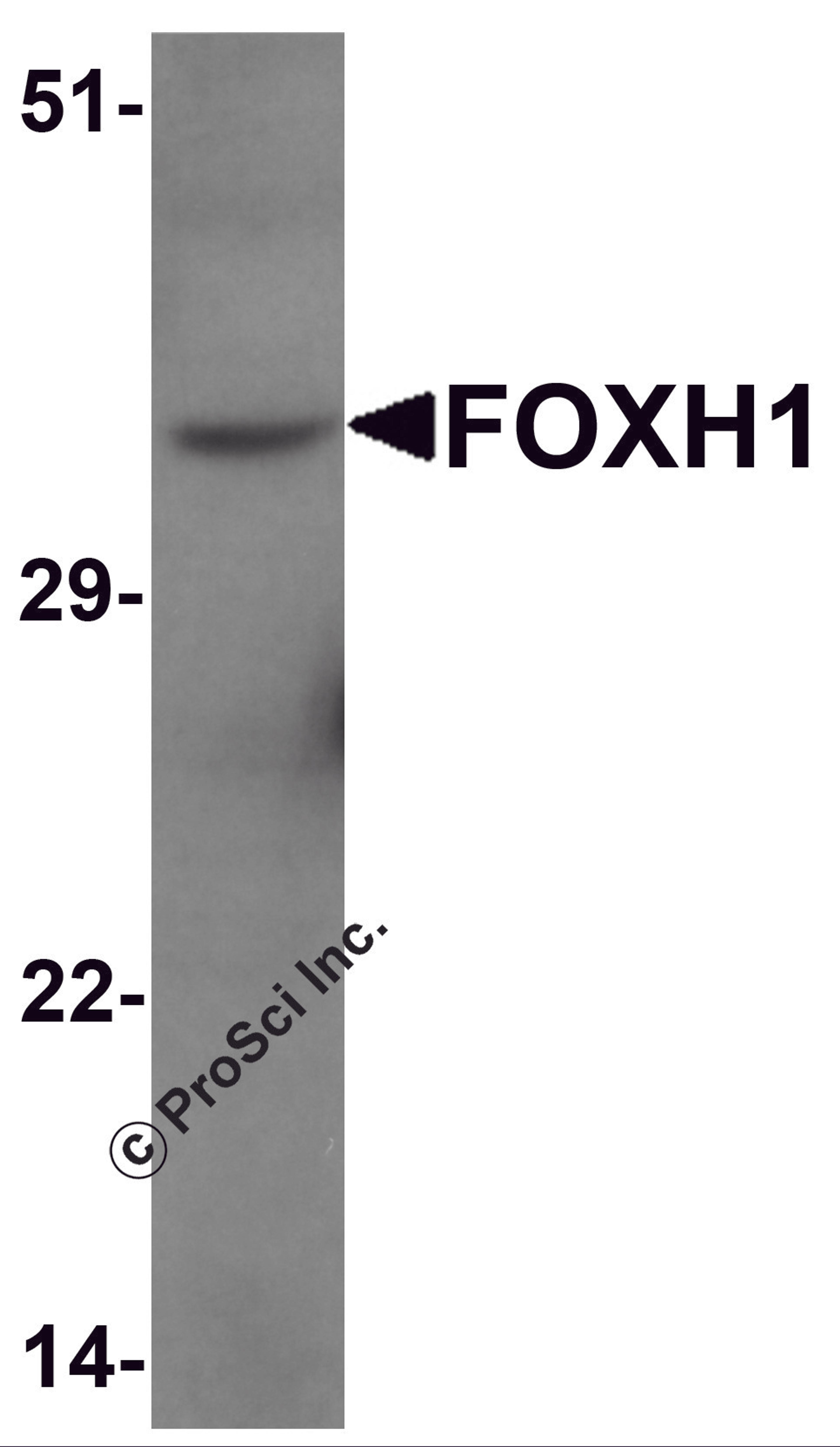 Western blot analysis of FOXH1 in human liver tissue lysate with FOXH1 antibody at 1 μg/mL.