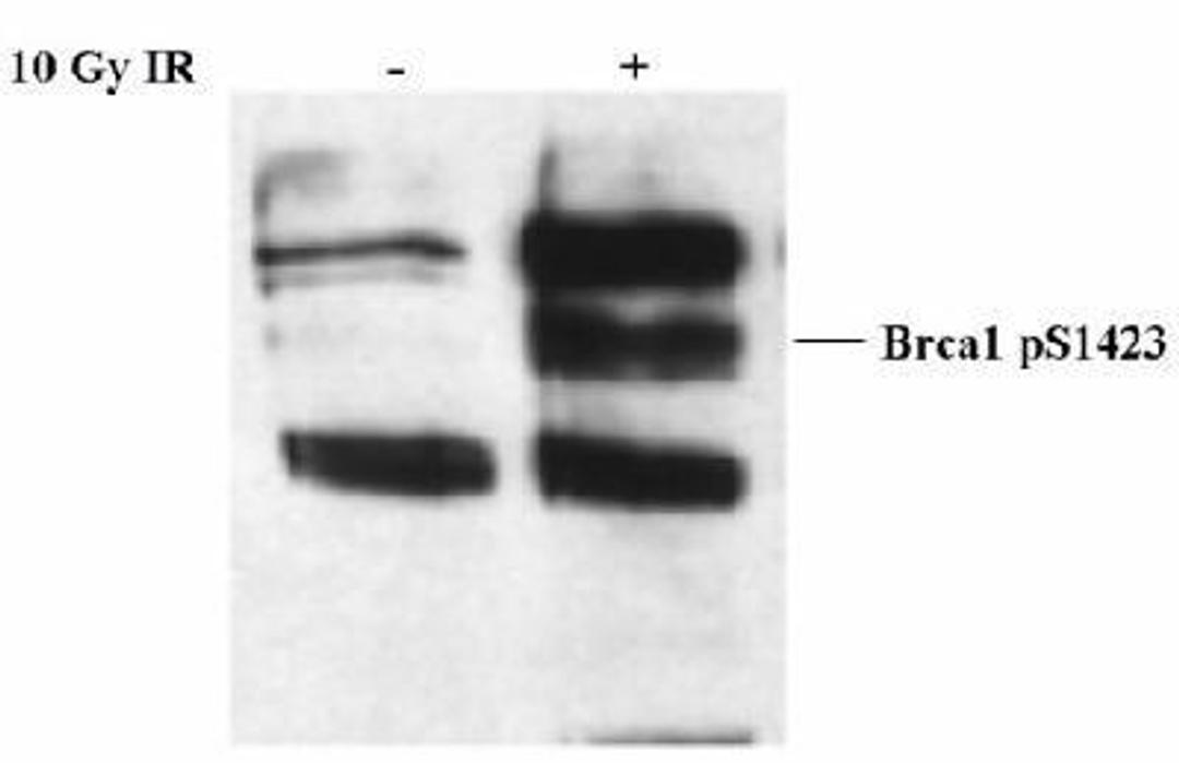 Western Blot: BRCA1 [p Ser1423] Antibody [NB100-226] - Detection of Brca1 phospho Ser 1423 by Western blot using NB 100-226.  Sample whole cell lysate (25 mcg/lane) from HeLa cells treated with 10 Gy IR or untreated.  NB 100-226 was used at 1:2500 dilution.