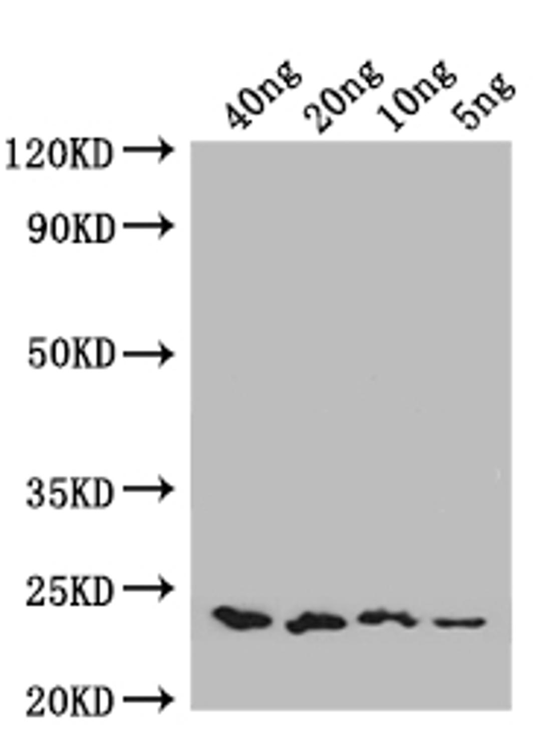 Western Blot. Positive WB detected in: recombinant protein. All lanes: ENT1 Antibody at 1:1000. Secondary. Goat polyclonal to rabbit IgG at 1/50000 dilution. Predicted band size: 22 kDa. Observed band size: 22 kDa.