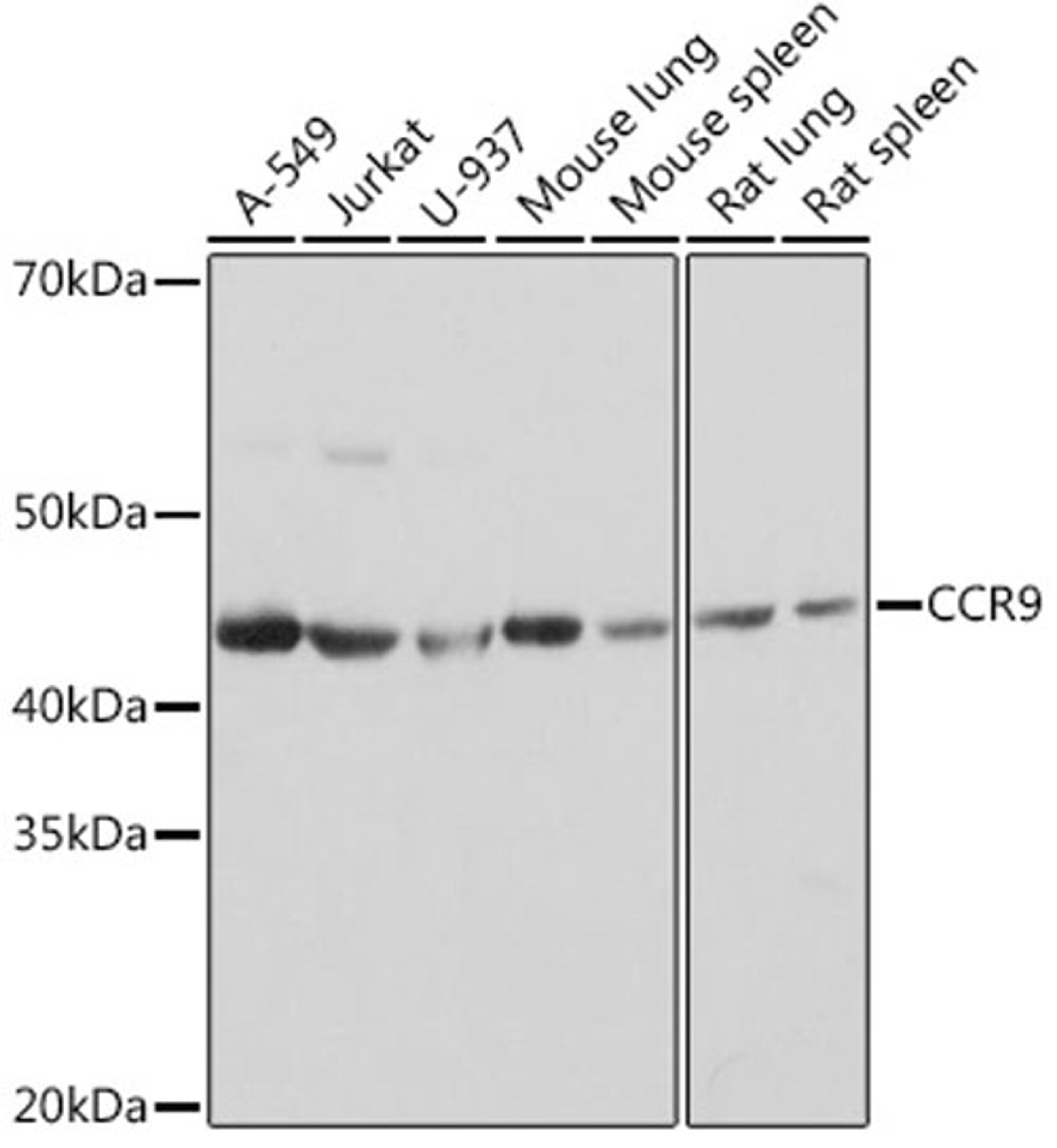 Western blot - CCR9 Rabbit mAb (A9698)