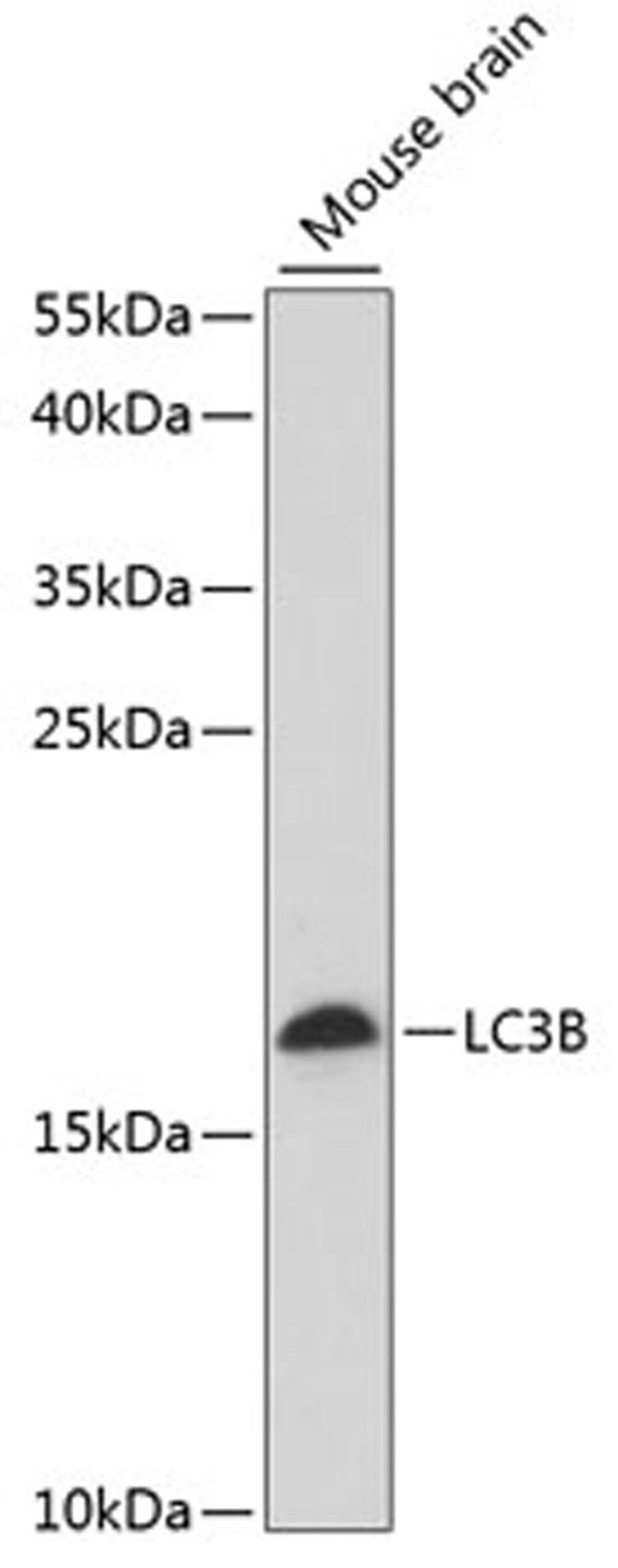 Western blot - LC3B antibody (A15592)