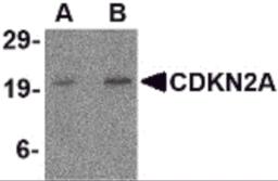 Western blot analysis of CDKN2A in mouse colon tissue lysate with CDKN2A antibody at (A) 1 and (B) 2 &#956;g/mL.