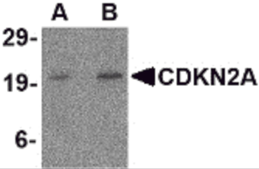 Western blot analysis of CDKN2A in mouse colon tissue lysate with CDKN2A antibody at (A) 1 and (B) 2 μg/mL.