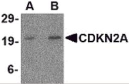 Western blot analysis of CDKN2A in mouse colon tissue lysate with CDKN2A antibody at (A) 1 and (B) 2 μg/mL.