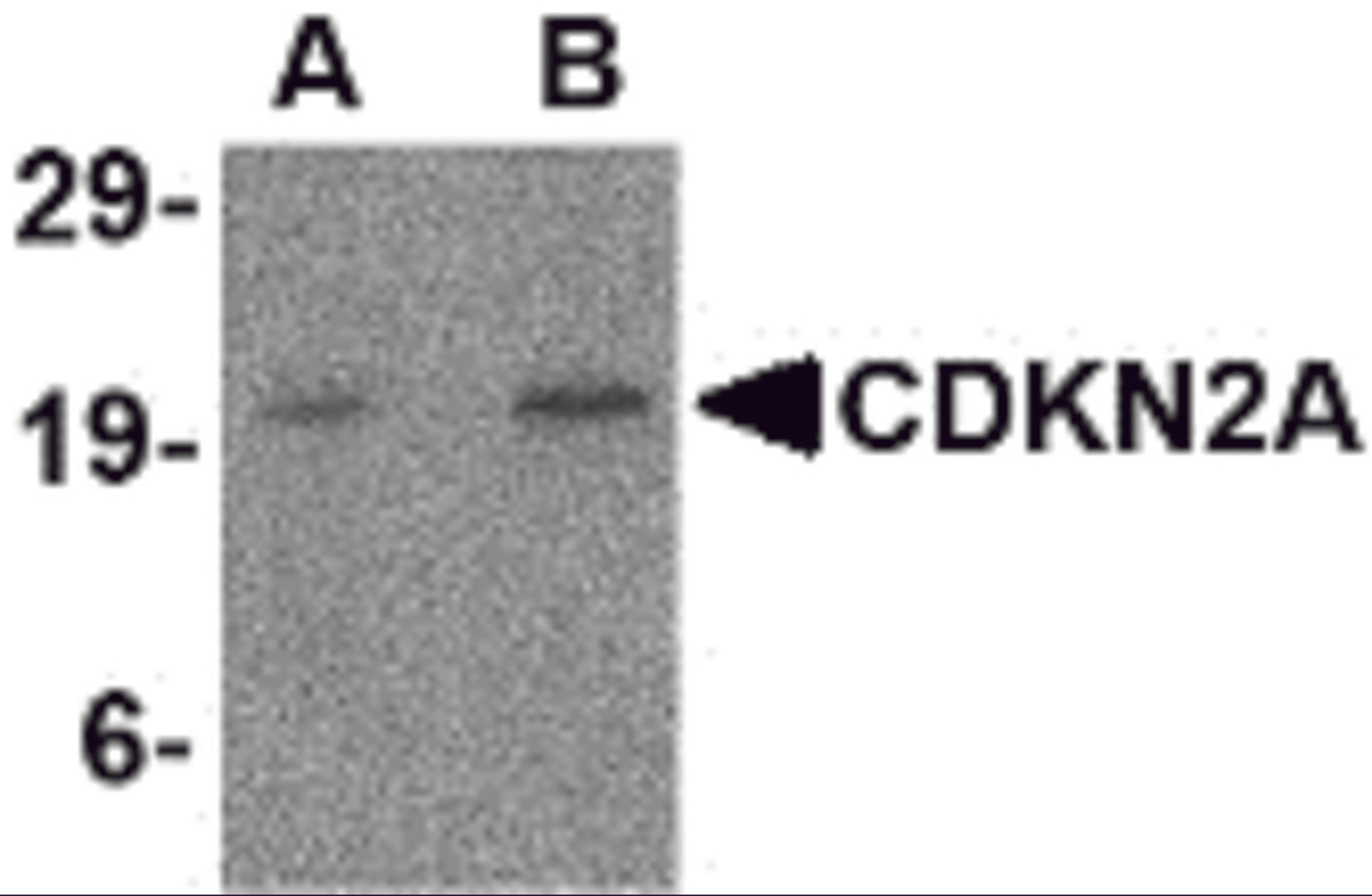 Western blot analysis of CDKN2A in mouse colon tissue lysate with CDKN2A antibody at (A) 1 and (B) 2 μg/mL.