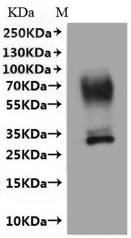 CSB-MP615678HU(A4)-C is detected by Mouse anti-6*His monoclonal antibody.