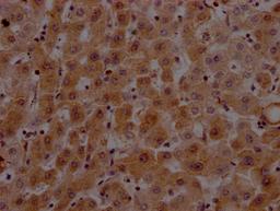 IHC image of CSB-RA912740A0HU diluted at 1:100 and staining in paraffin-embedded human liver tissue performed on a Leica BondTM system. After dewaxing and hydration, antigen retrieval was mediated by high pressure in a citrate buffer (pH 6.0). Section was blocked with 10% normal goat serum 30min at RT. Then primary antibody (1% BSA) was incubated at 4℃ overnight. The primary is detected by a Goat anti-rabbit IgG polymer labeled by HRP and visualized using 0.05% DAB.