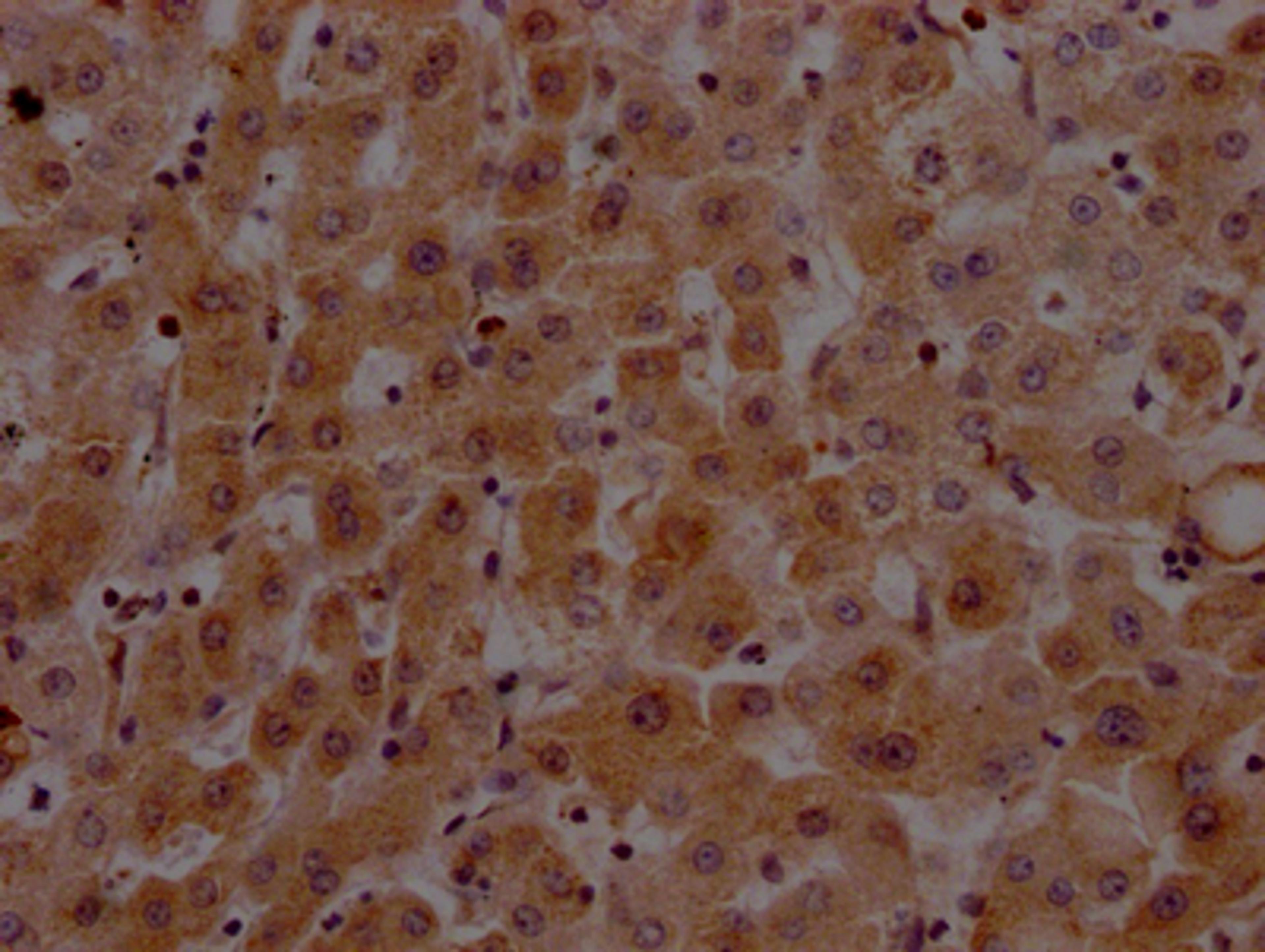 IHC image of CSB-RA912740A0HU diluted at 1:100 and staining in paraffin-embedded human liver tissue performed on a Leica BondTM system. After dewaxing and hydration, antigen retrieval was mediated by high pressure in a citrate buffer (pH 6.0). Section was blocked with 10% normal goat serum 30min at RT. Then primary antibody (1% BSA) was incubated at 4℃ overnight. The primary is detected by a Goat anti-rabbit IgG polymer labeled by HRP and visualized using 0.05% DAB.