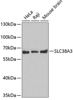 Western blot - SLC38A3 antibody (A4472)