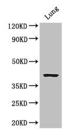 Western Blot. Positive WB detected in: Mouse lung tissue. All lanes: CYSLTR1 antibody at 3ug/ml. Secondary. Goat polyclonal to rabbit IgG at 1/50000 dilution. Predicted band size: 39 kDa. Observed band size: 39 kDa. 