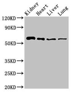 Western Blot. Positive WB detected in: Mouse kidney tissue, Rat heart tissue, Rat liver tissue, Rat lung tissue. All lanes: SLC22A2 antibody at 2.7ug/ml. Secondary. Goat polyclonal to rabbit IgG at 1/50000 dilution. Predicted band size: 63, 55, 27 kDa. Observed band size: 63 kDa. 