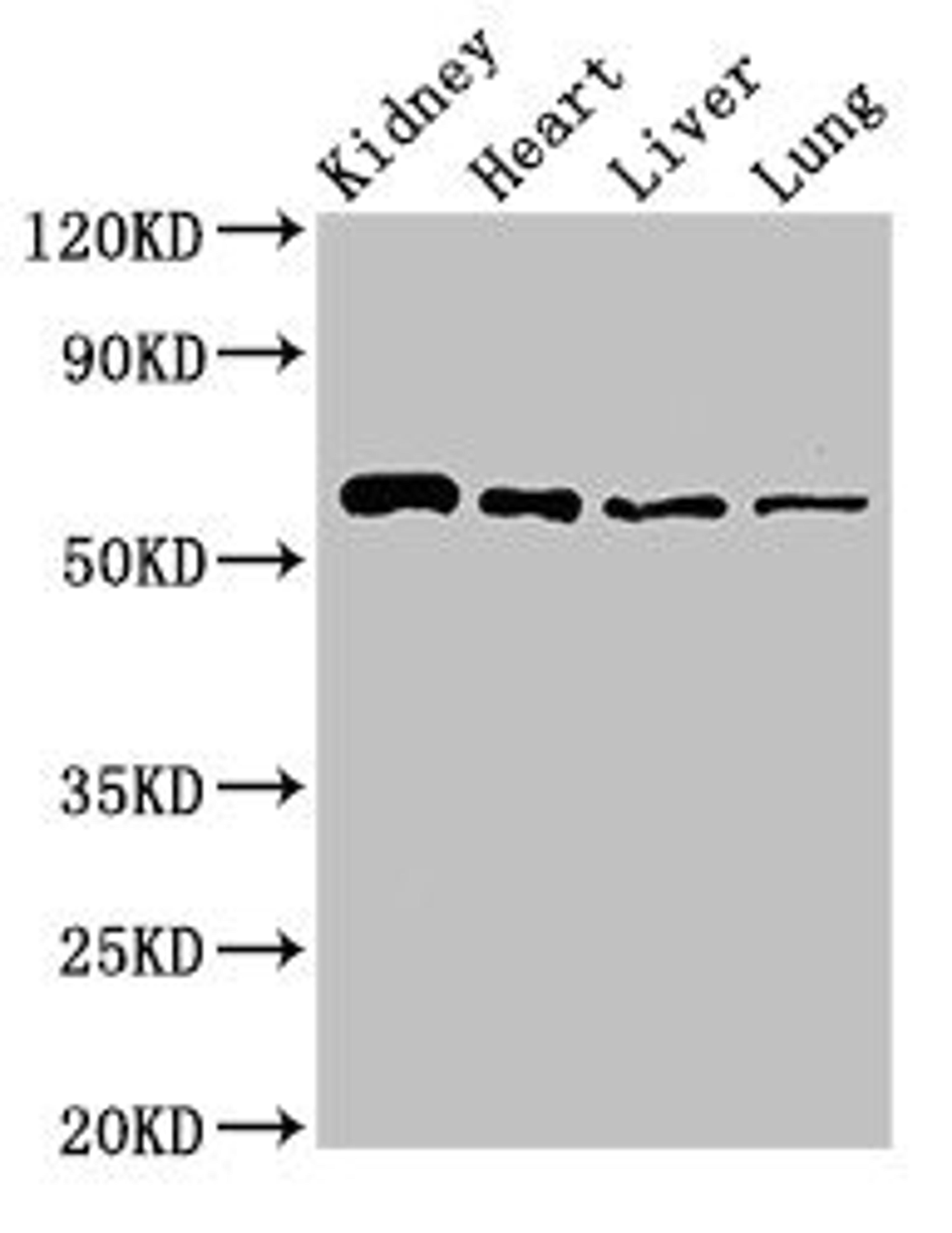 Western Blot. Positive WB detected in: Mouse kidney tissue, Rat heart tissue, Rat liver tissue, Rat lung tissue. All lanes: SLC22A2 antibody at 2.7ug/ml. Secondary. Goat polyclonal to rabbit IgG at 1/50000 dilution. Predicted band size: 63, 55, 27 kDa. Observed band size: 63 kDa. 