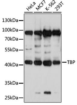 Western blot - TBP antibody (A2192)