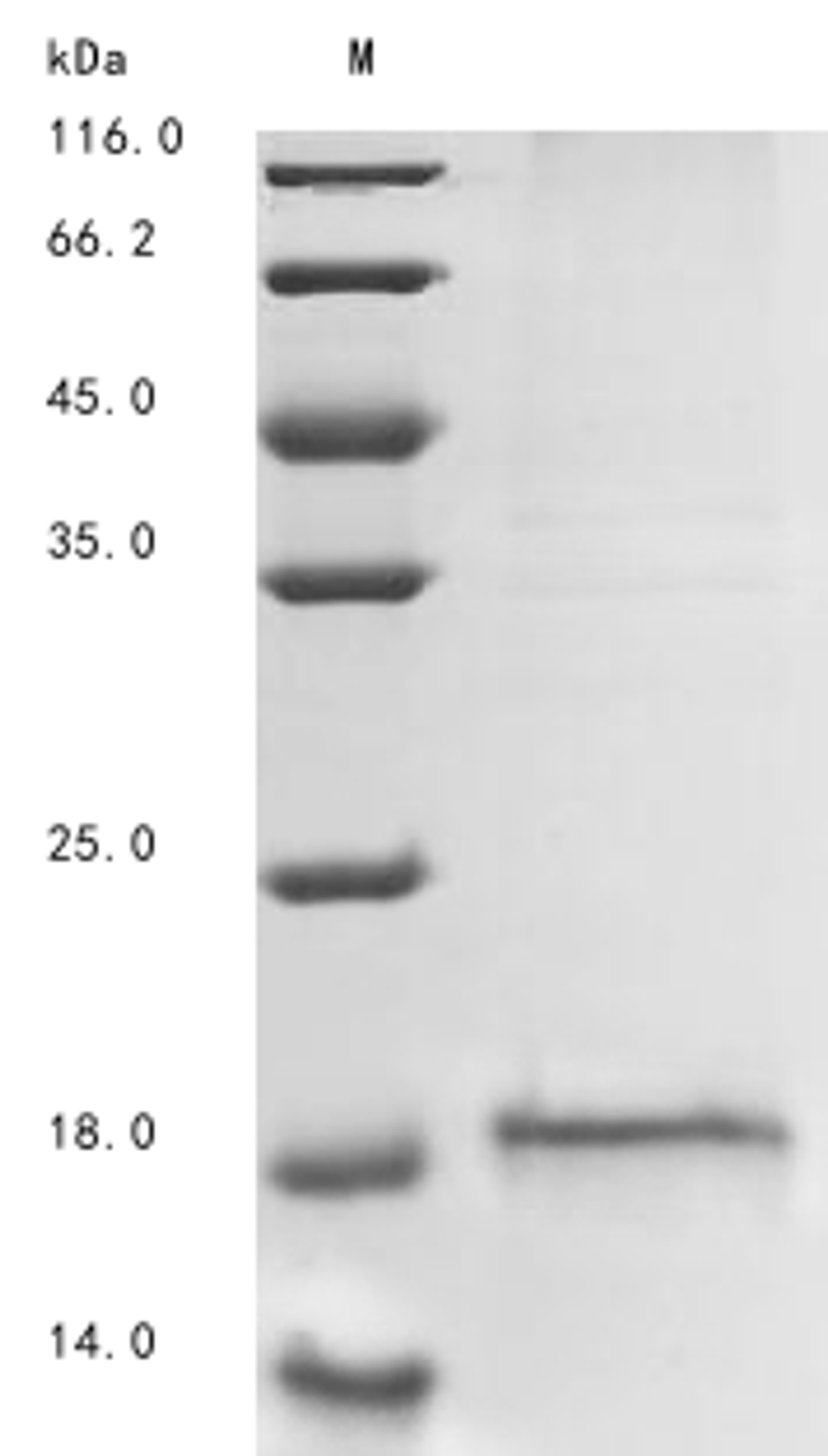 (Tris-Glycine gel) Discontinuous SDS-PAGE (reduced) with 5% enrichment gel and 15% separation gel.
