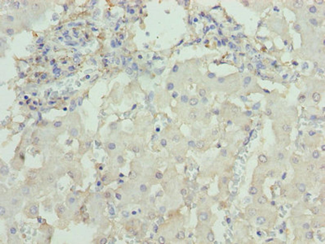 Immunohistochemistry of paraffin-embedded human liver tissue using CSB-PA006576LA01HU at dilution of 1:100