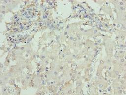 Immunohistochemistry of paraffin-embedded human liver tissue using CSB-PA006576LA01HU at dilution of 1:100