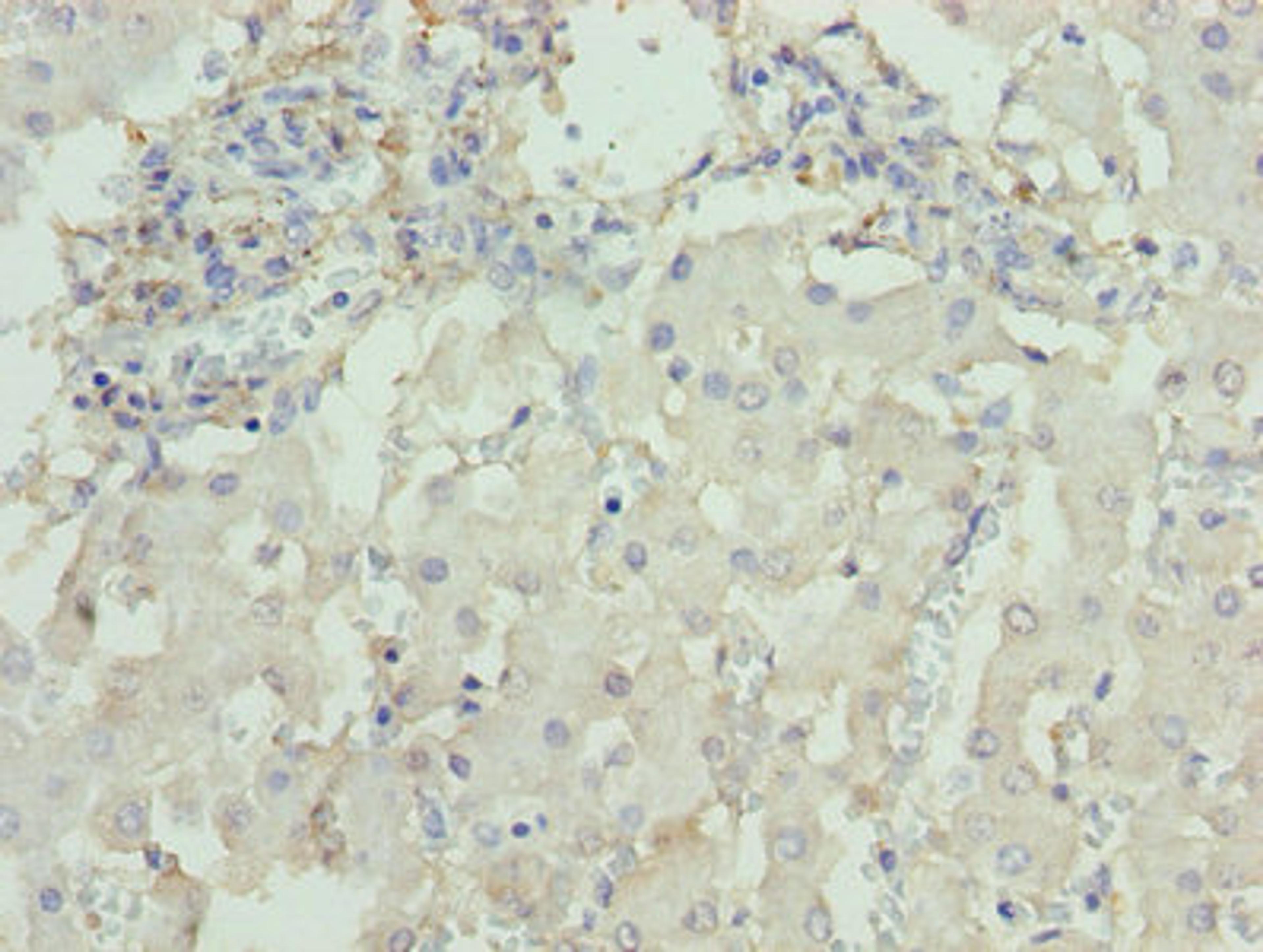 Immunohistochemistry of paraffin-embedded human liver tissue using CSB-PA006576LA01HU at dilution of 1:100