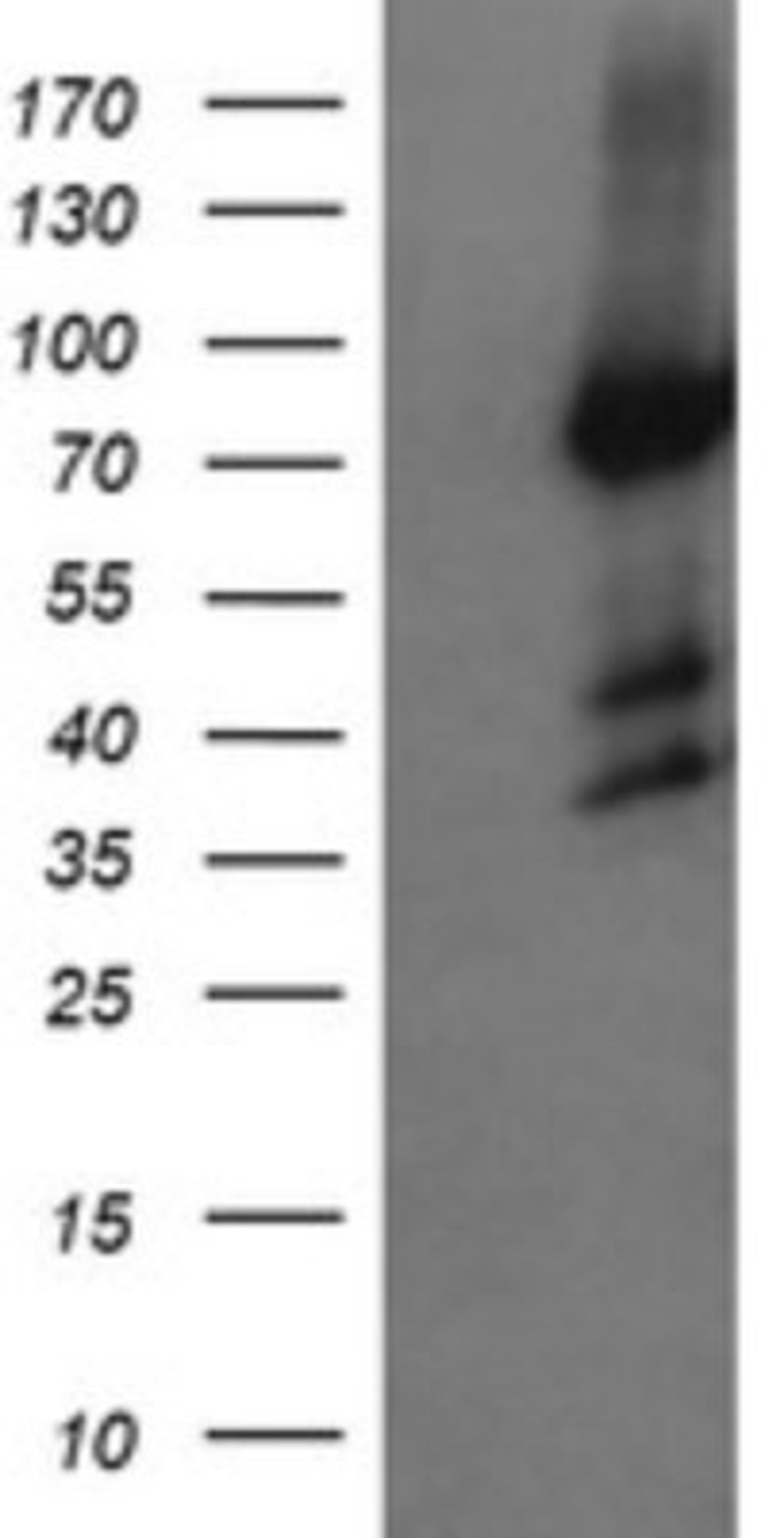 Western Blot: Host cell factor C2 Antibody (5H9) [NBP2-45733] - Analysis of HEK293T cells were transfected with the pCMV6-ENTRY control (Left lane) or pCMV6-ENTRY Host cell factor C2.