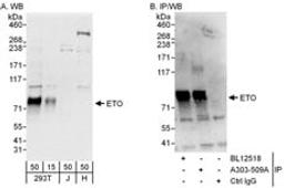 Detection of human ETO by western blot and immunoprecipitation.