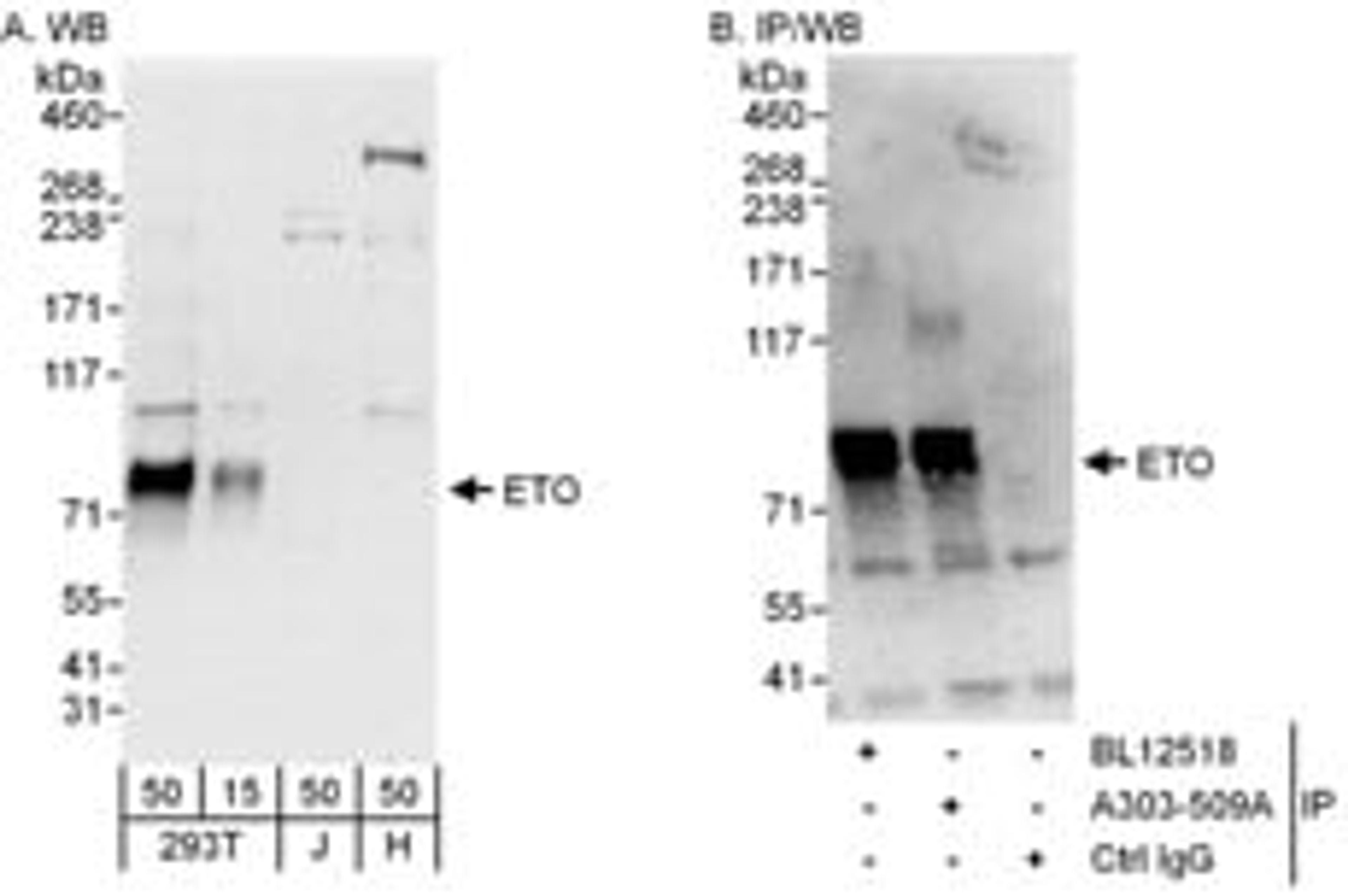 Detection of human ETO by western blot and immunoprecipitation.