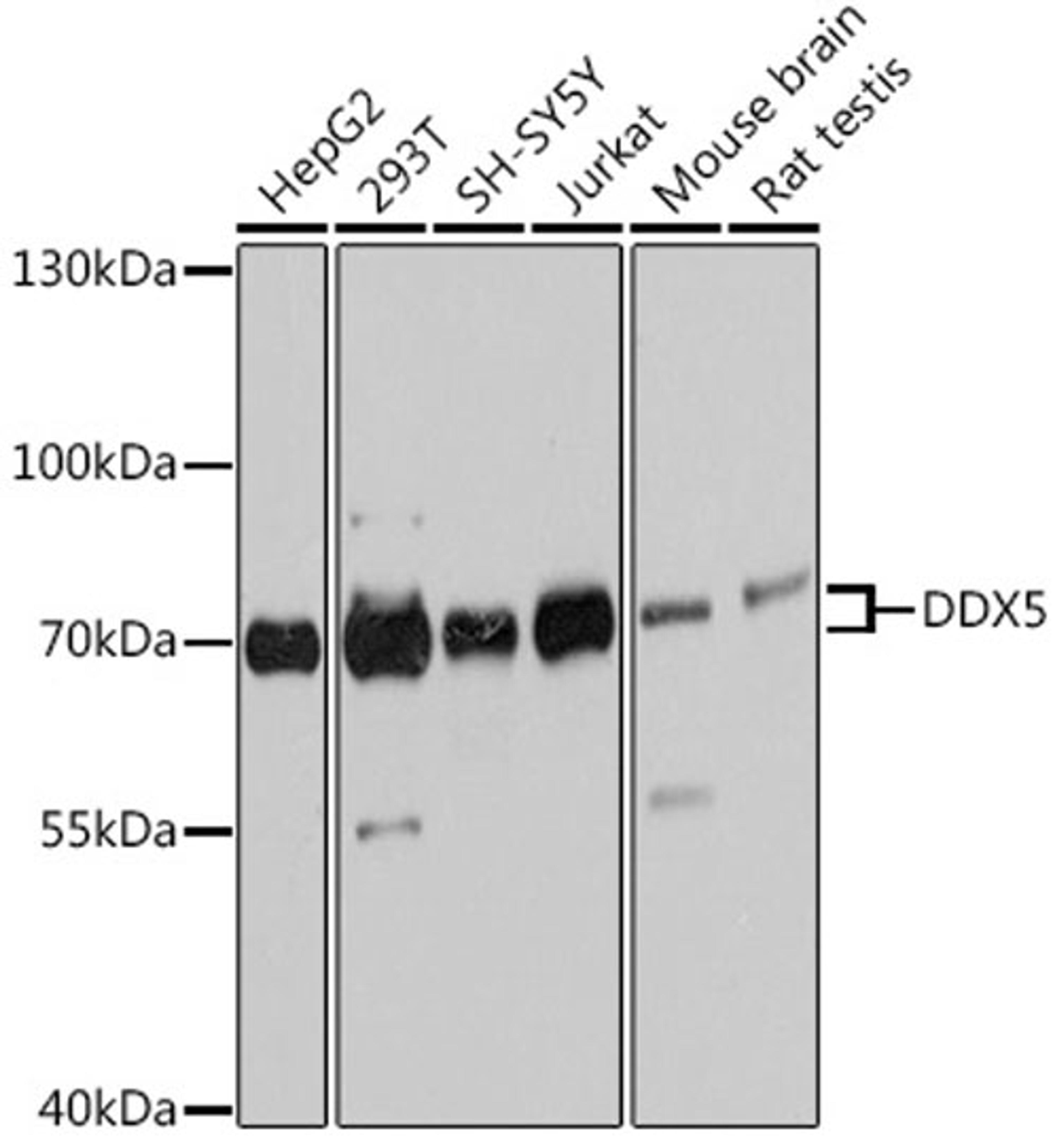 Western blot - DDX5 antibody (A13294)