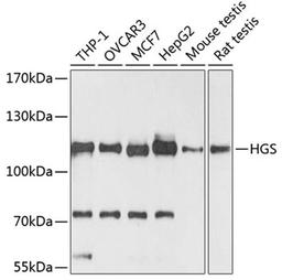 Western blot - HGS antibody (A1790)