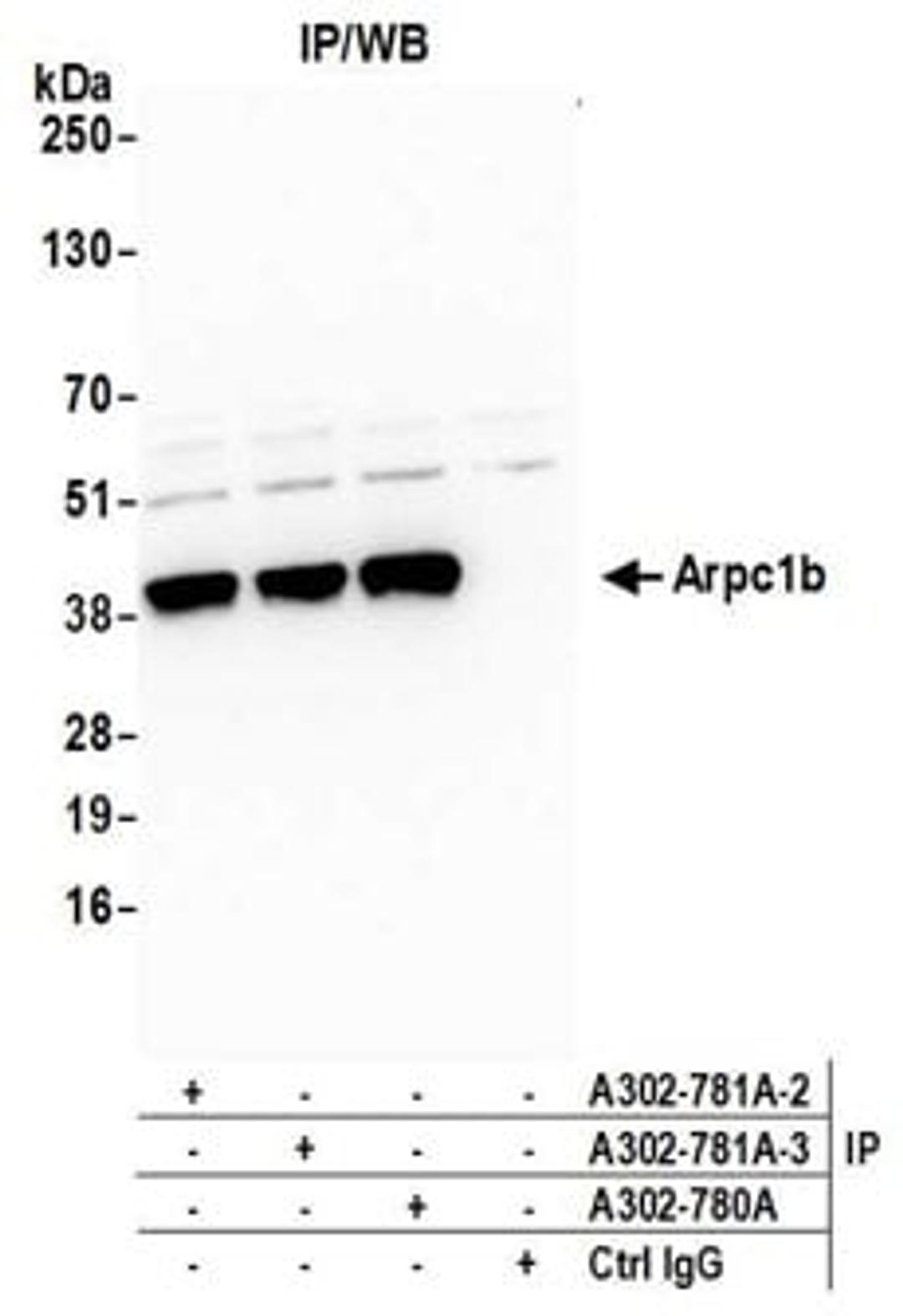 Detection of human Arpc1b by western blot of immunoprecipitates.