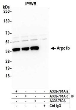 Detection of human Arpc1b by western blot of immunoprecipitates.