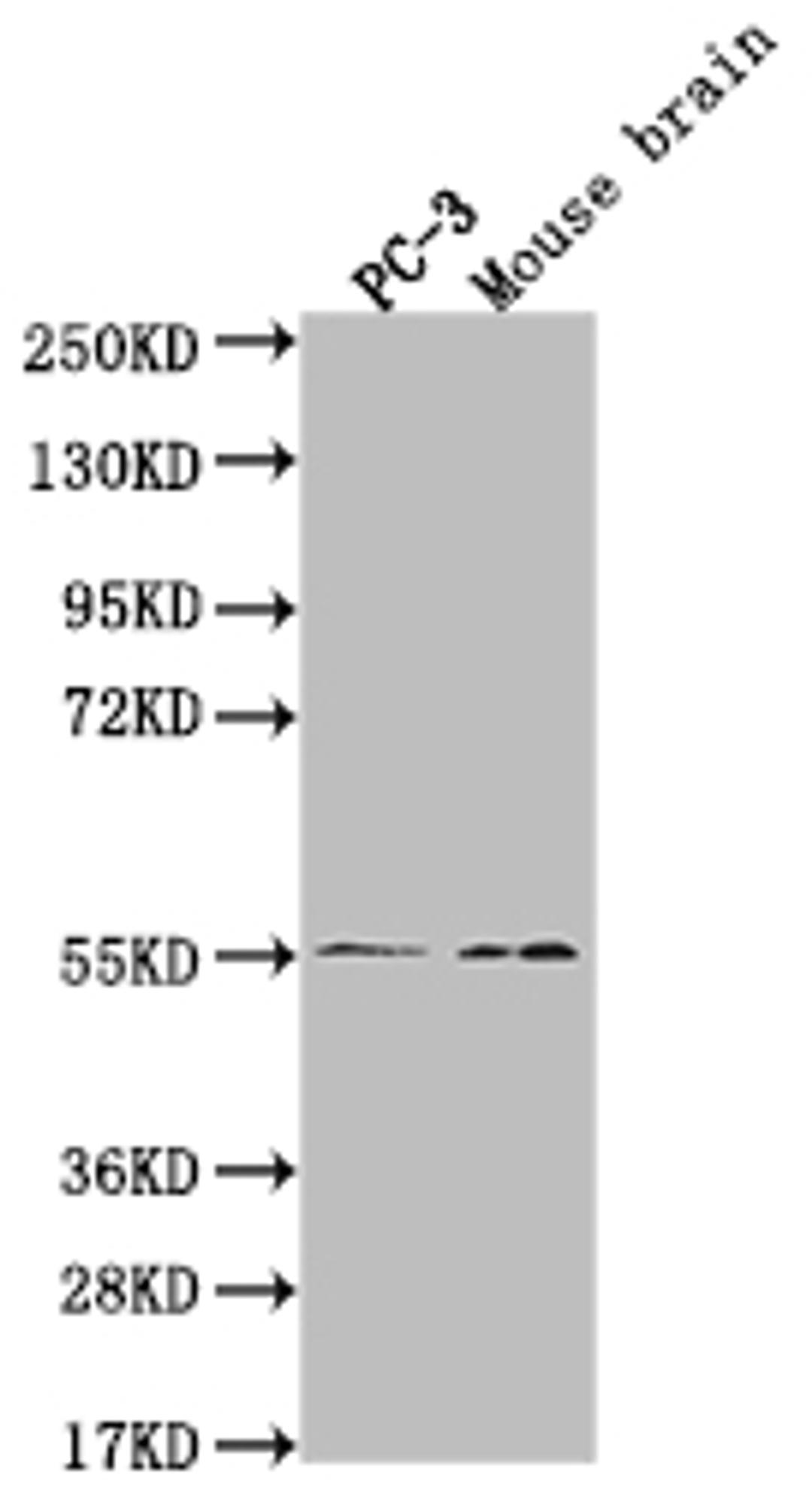 Western Blot. Positive WB detected in: PC-3 whole cell lysate, Mouse brain tissue. All lanes: MAPK10 antibody at 1:2000. Secondary. Goat polyclonal to rabbit IgG at 1/50000 dilution. Predicted band size: 53, 49, 32kDa. Observed band size: 55 kDa. 