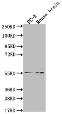 Western Blot. Positive WB detected in: PC-3 whole cell lysate, Mouse brain tissue. All lanes: MAPK10 antibody at 1:2000. Secondary. Goat polyclonal to rabbit IgG at 1/50000 dilution. Predicted band size: 53, 49, 32kDa. Observed band size: 55 kDa. 
