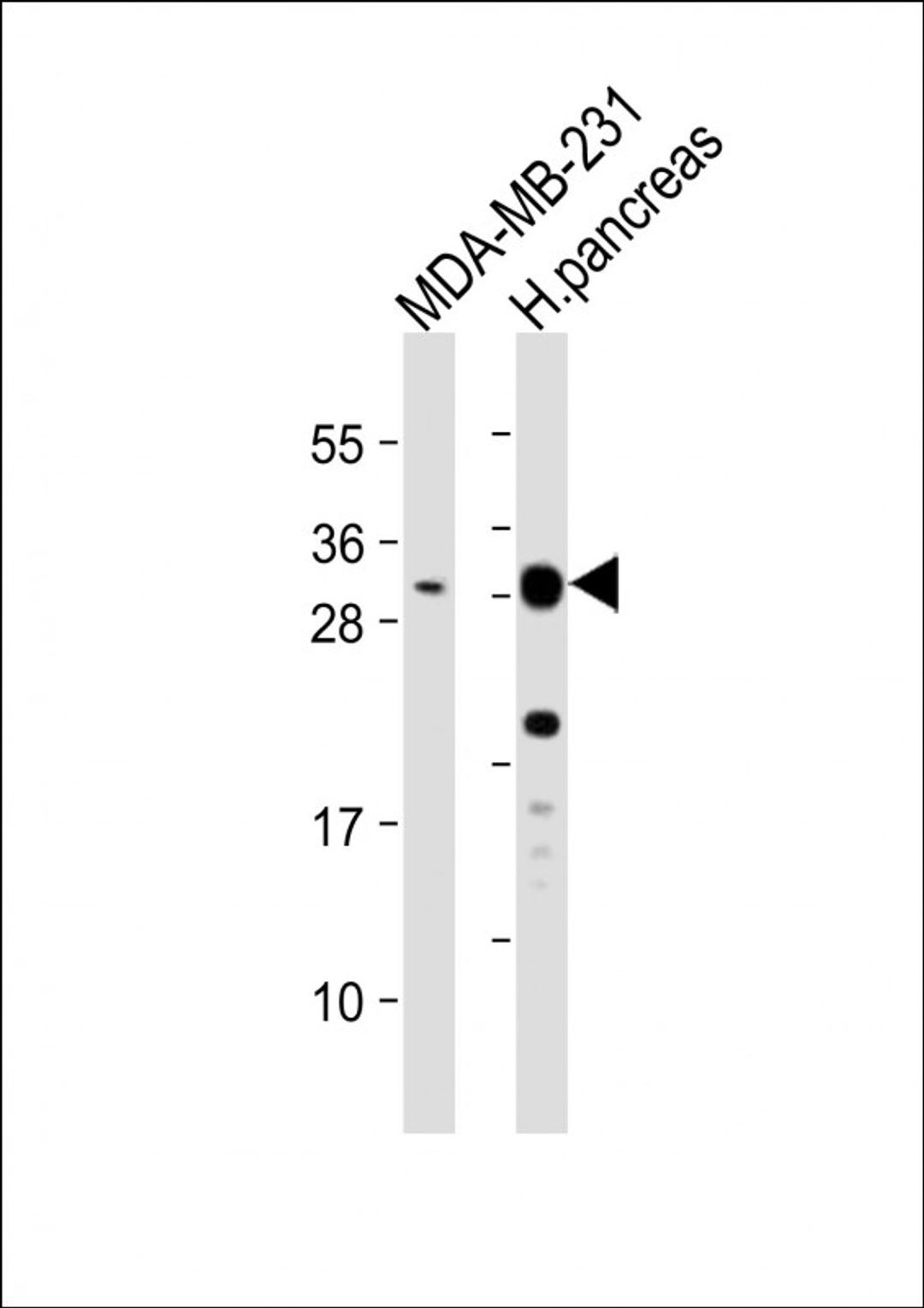 Western Blot at 1:1000 dilution Lane 1: MDA-MB-231 whole cell lysate Lane 2: human pancreas lysate Lysates/proteins at 20 ug per lane.