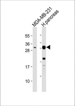 Western Blot at 1:1000 dilution Lane 1: MDA-MB-231 whole cell lysate Lane 2: human pancreas lysate Lysates/proteins at 20 ug per lane.