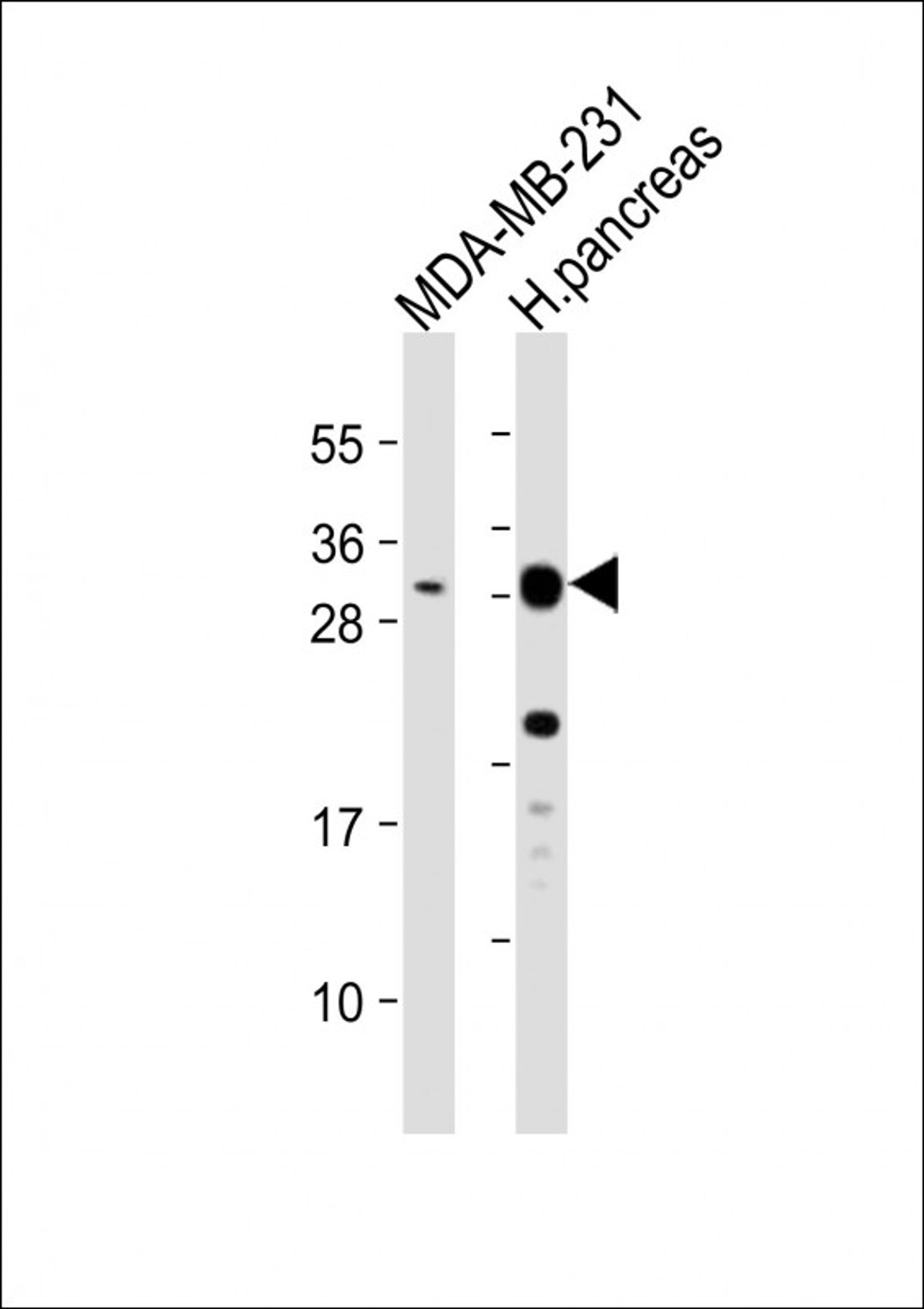 Western Blot at 1:1000 dilution Lane 1: MDA-MB-231 whole cell lysate Lane 2: human pancreas lysate Lysates/proteins at 20 ug per lane.