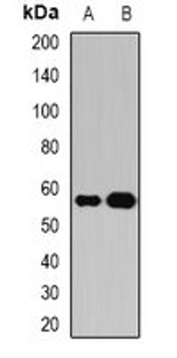 Western blot analysis of HepG2 (Lane1), COS7 (Lane2) whole cell lysates using PPAT antibody