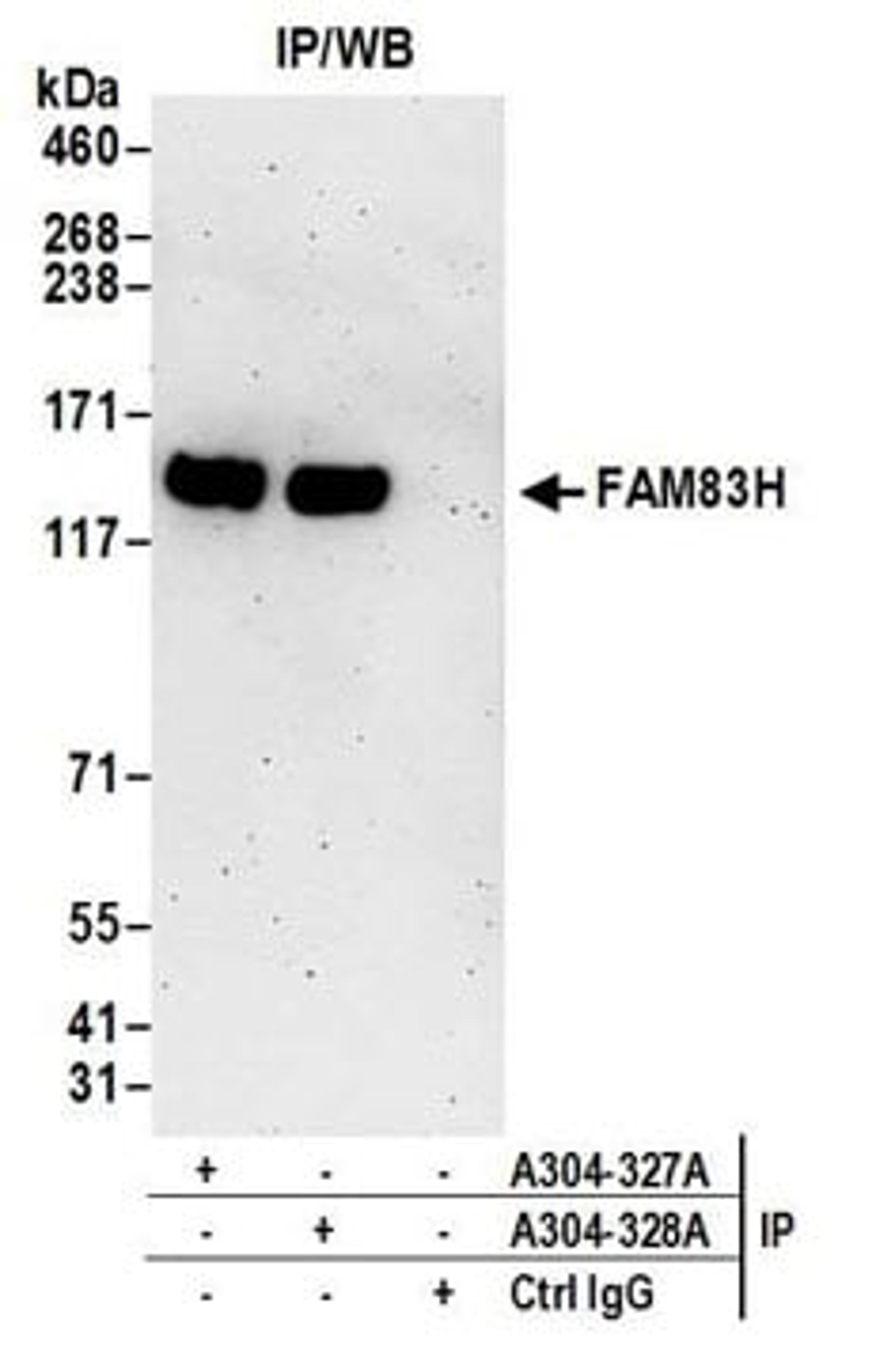 Detection of human FAM83H by western blot of immunoprecipitates.