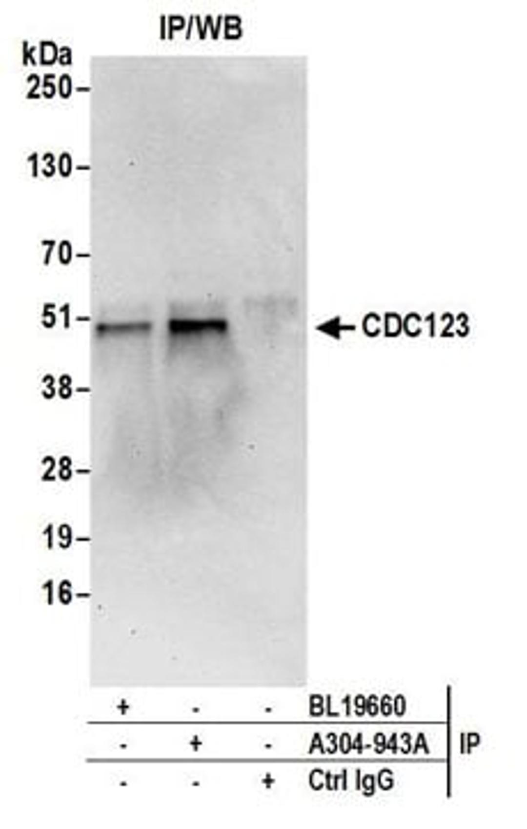 Detection of human CDC123 by western blot of immunoprecipitates.