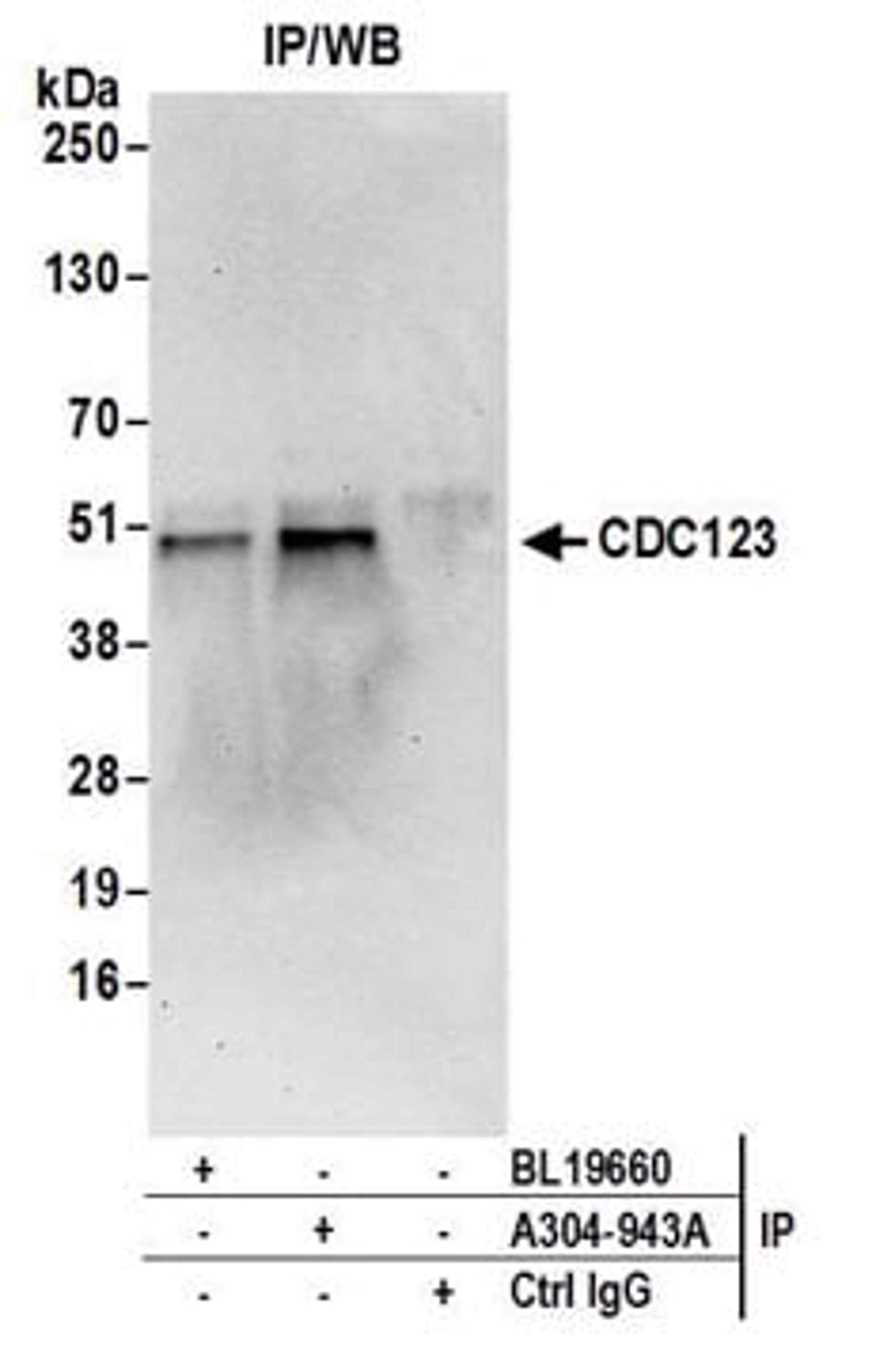 Detection of human CDC123 by western blot of immunoprecipitates.