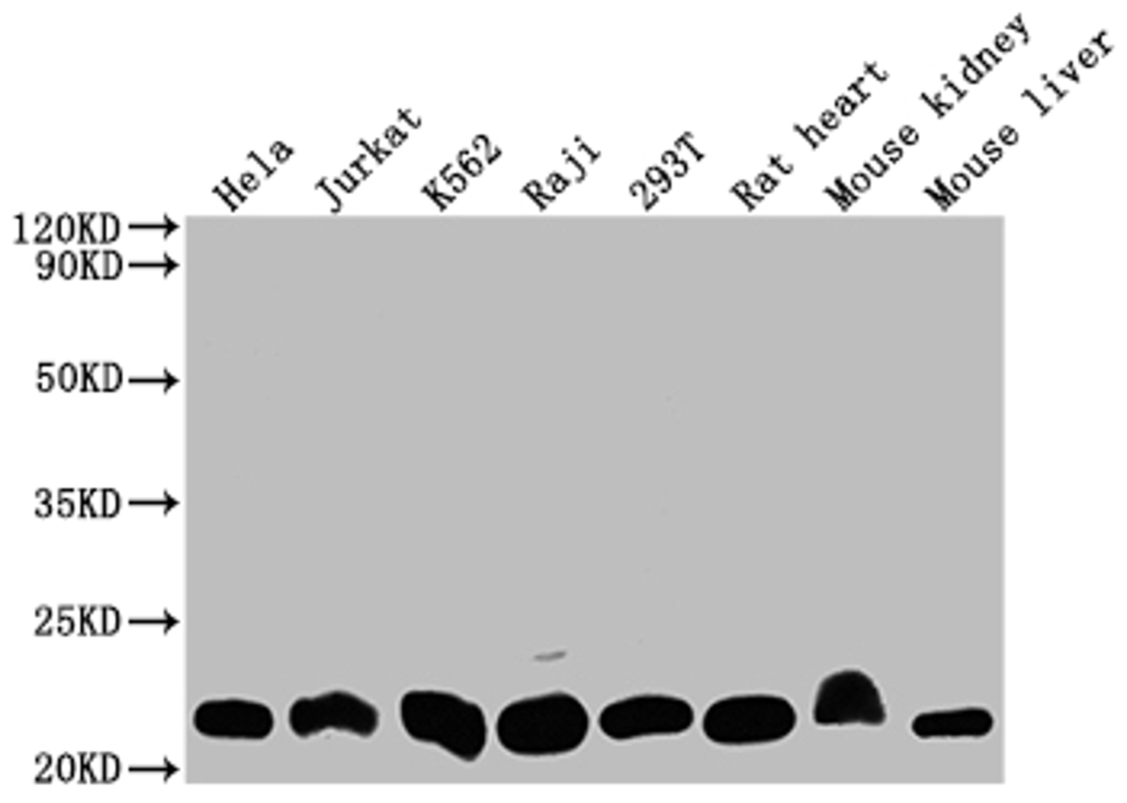 Western Blot. Positive WB detected in: Hela whole cell lysate, Jurkat whole cell lysate, K562 whole cell lysate, Raji whole cell lysate, 293T whole cell lysate, Rat heart tissue, Mouse kidney tissue, Mouse liver tissue. All lanes: DHFR antibody at 1:2000. Secondary. Goat polyclonal to rabbit IgG at 1/50000 dilution. Predicted band size: 22, 16 kDa. Observed band size: 22 kDa.